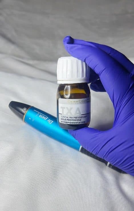 TXA Despigmentante — Berke Spa Vitacura