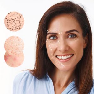 rejuvenecimiento facial de + 30 años (Fillmed) | Berke SPA