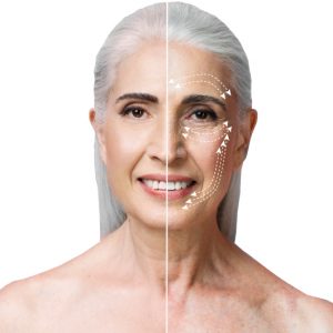 Tratamiento de rejuvenecimiento facial